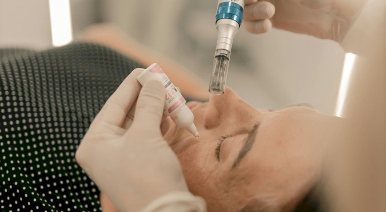Zabieg na twarz | Szczecin | Skinmed